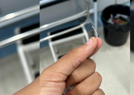 Mulher tem esôfago perfurado ao engasgar com espinha de peixe e morre