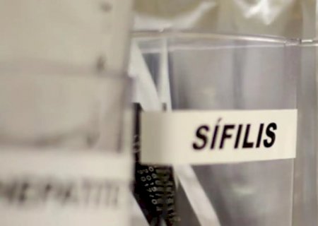 SUS passa a adotar antibiótico para prevenir sífilis e clamídia
