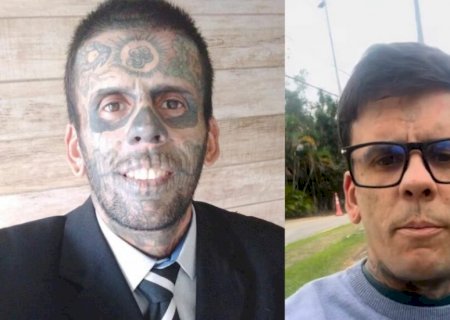 Mais tatuado do Brasil descobre tumor antes de apagar tatuagem
